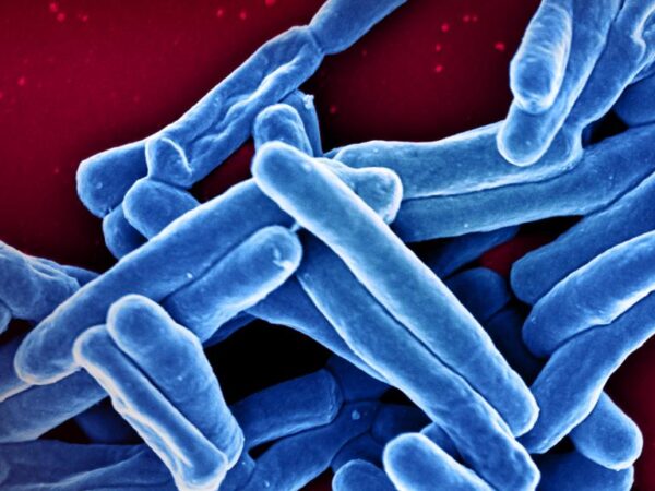 Bacteria Tuberculosis